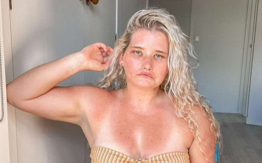 Tiene un síndrome que le impide sonreír y se convirtió en modelo para inspirar a otros