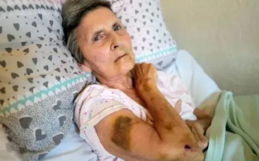 Imágenes sensibles: una rata gigante atacó a una señora postrada y de milagro fue rescatada por un vecino