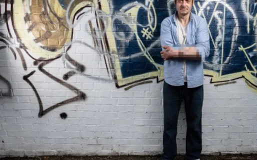 Insólito: un hombre vivió 6 años con su pene en el brazo