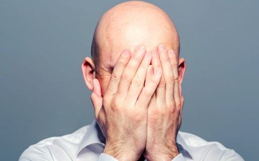 Llamar “calvo” a un hombre en el trabajo es acoso sexual