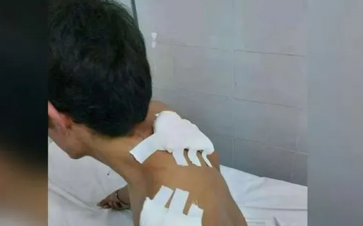 Le dio cinco puñaladas al novio de su hermana: era su amigo y lo sintió una traición