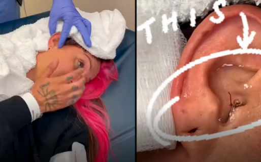 Estaba durmiendo y se le metió una cucaracha en el oído: terminó en el hospital