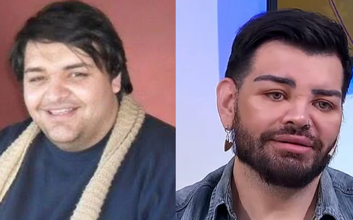 Se hizo más de 30 cirugías en la cara: “Ahora quedé más lindo que Ricky Martin”