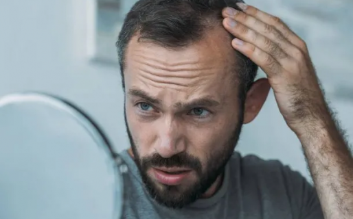 Los hombres que se masturban corren más riesgo de quedarse pelados