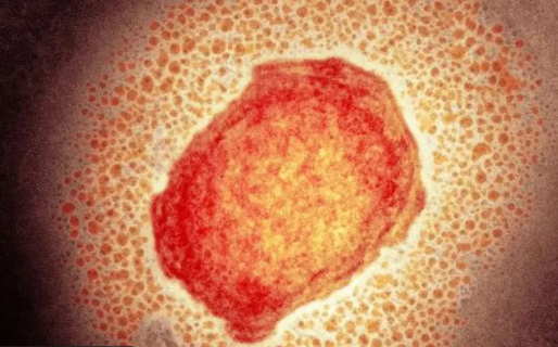 Cómo se contagia la viruela del mono y cuáles son los síntomas para detectarla