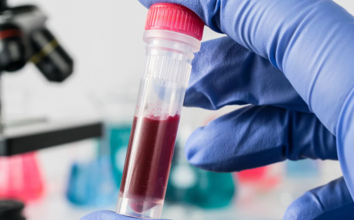 Investigadores desarrollan un posible tratamiento contra el HIV basado en una sola inyección