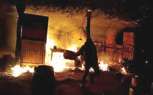 Se durmió fumando y se despertó con el 90% del cuerpo quemado