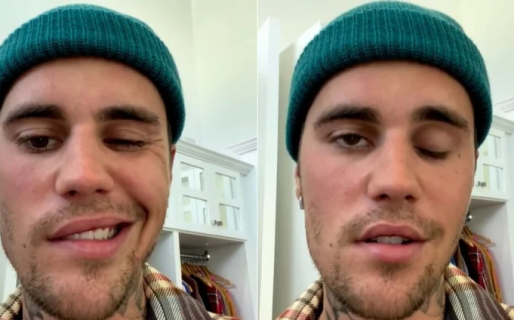 Justin Bieber confesó que sufre de parálisis en la mitad del rostro por un virus: “Es muy grave”