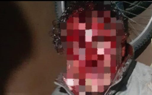 Brutal ataque a un jubilado para robarle herramientas