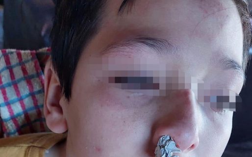 Cruel golpiza a un menor en una escuela de Comodoro