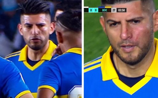 ¿Otro lío en puerta? Zambrano apareció con una escoriación en el rostro y señalan a Benedetto