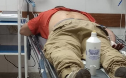Fue a la Comisaría por presentar una herida de arma blanca y quedó detenido por tener pedido de captura