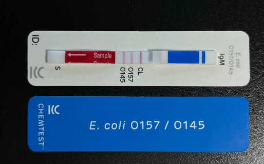 Cómo es el revolucionario test que detecta el síndrome urémico hemolítico en 10 minutos