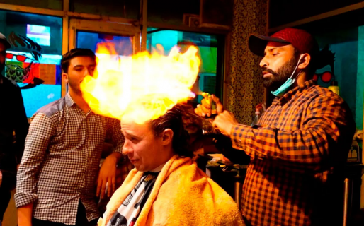 Vio en las redes un corte de pelo con fuego, intentó hacérselo a un amigo y lo dejó con graves quemaduras