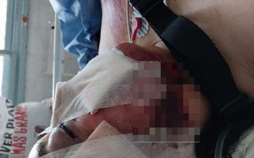Brutal intento de femicidio en Comodoro: la golpeó hasta dejarla inconsciente