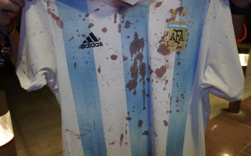 El duro relato del hincha golpeado por cuatro mexicanos: “Nos gritaron ‘argentinos de m…’ y nos pegaron”