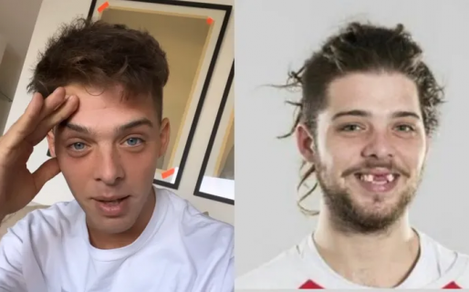 “Qué fiero que estaba”: Santi Maratea recordó cómo era su rostro sin dientes tras un accidente