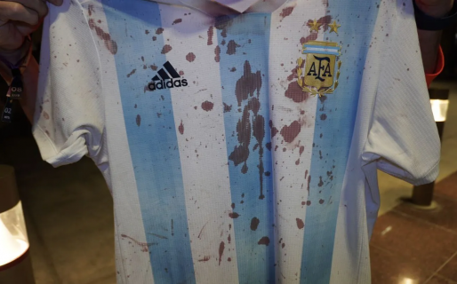 El duro relato del hincha golpeado por cuatro mexicanos: “Nos gritaron ‘argentinos de m…’ y nos pegaron”