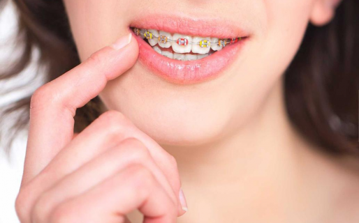 Insólito: le pide a su novia que no se saque los brackets “por cábala”