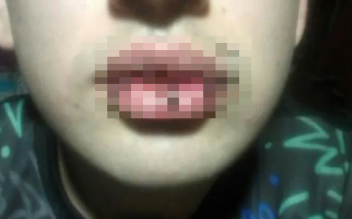 Un preso de Comodoro se cosió la boca en Trelew