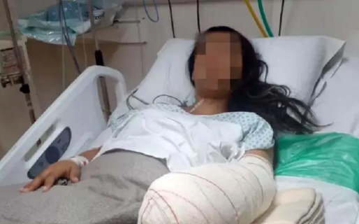 Una mujer fue al hospital para dar a luz y salió con una mano amputada