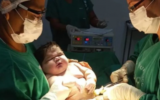 Nació un superbebé de más de 7 kilos y rompió un récord: “Lo imaginábamos más pequeño”