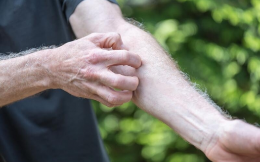 Fue al hospital por una picadura y le diagnosticaron una grave enfermedad