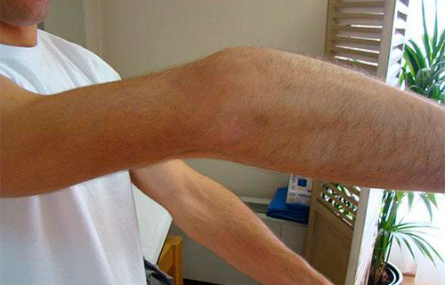 Entrenaba en el gimnasio y cometió un claro error que terminó costándole una fuerte lesión