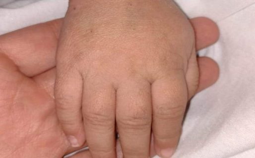 La familia de Gian Lucas continúa luchando por su derivación a Buenos Aires