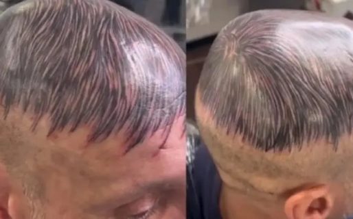 El más tranquilo: harto de ser pelado, decidió tatuarse una peluca