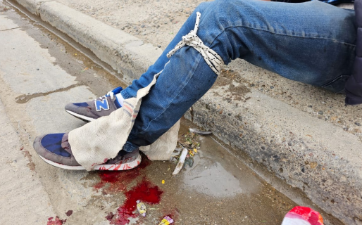 Recibió un disparo en su pierna pero se negó a hacer la denuncia