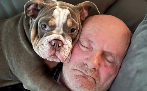 Su perro le comió un dedo mientras dormía: los médicos le dijeron que le salvó la vida