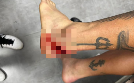La impresionante lesión de un jugador de San Lorenzo que no valió ni amarilla