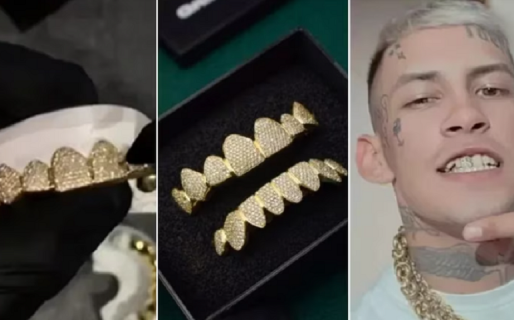 Los dientes de oro y diamantes de L-Gante y una riesgosa moda estética