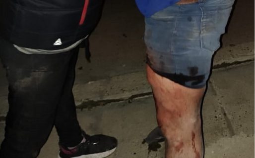 El cuñado lo apuñaló tras una discusión familiar pero no hará la denuncia