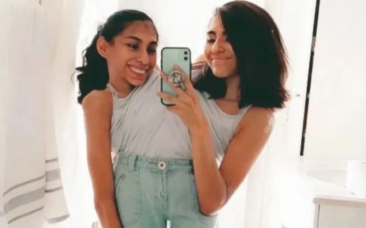 Son siamesas, una tiene novio y contó el acuerdo íntimo que que tiene con su hermana