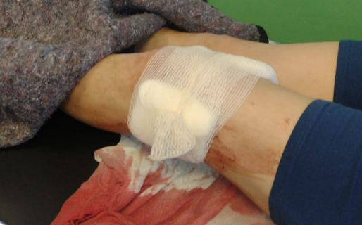 Baleado por uno de los Nieves, pero sin intención de realizar la denuncia