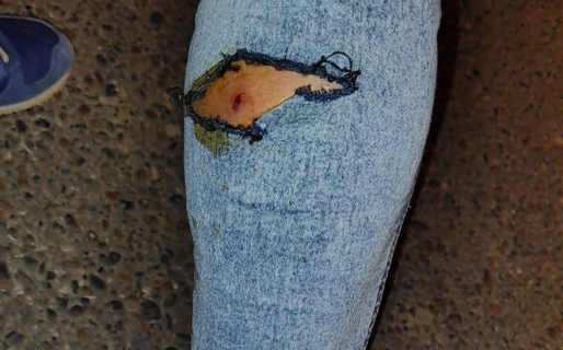 Una mujer fue atacada por tres canes en Castelli y terminó en el hospital