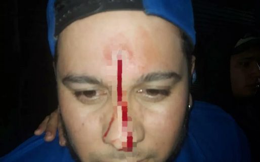 Cansado del ruido, un hombre disparó al cantante de una banda