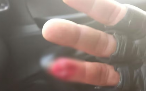 Se resistió a un control, le mordió el dedo a un policía y se lo tragó