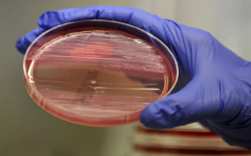 Aumento del síndrome urémico hemolítico en Argentina: síntomas y cómo prevenirlo