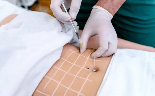 Crece la cantidad de uruguayos que viaja a Argentina a hacerse cirugías estéticas