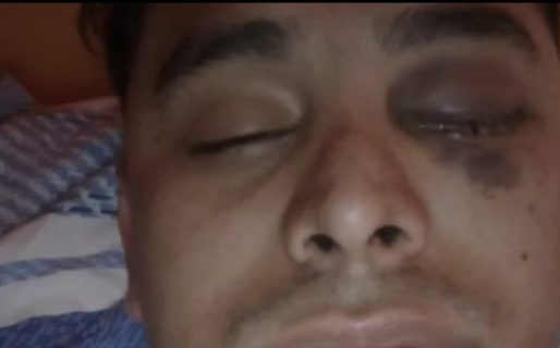 Se atrasó con el pago del alquiler y el propietario lo agredió con una pistola: perdió la visión de un ojo