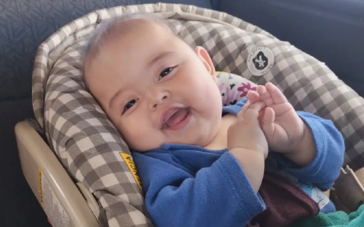 Un bebé necesita un costoso casco protector para sobrevivir tras una cirugía y la familia pide ayuda