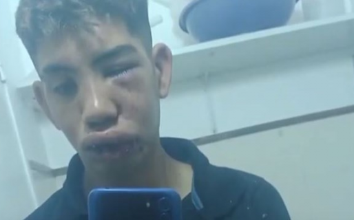 Brutal golpiza a un joven por una pelea de tránsito: «Podrían haberme matado»