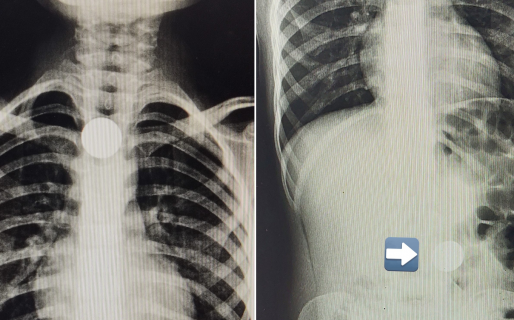 El chipá le salvó la vida