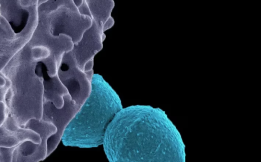 Alerta por una bacteria más agresiva: el brote por Streptococcus pyogenes ya causó 64 muertes en el país