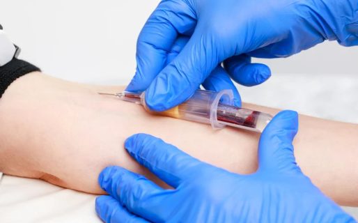 Prepagas cobrarán un ‘extra’ a afiliados por hacerse análisis de sangre y otros estudios