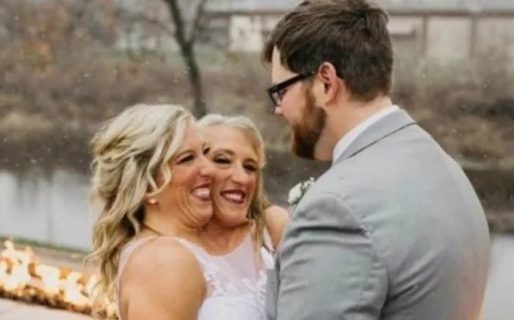Una de las famosas siamesas Hensel encontró el amor y se casó