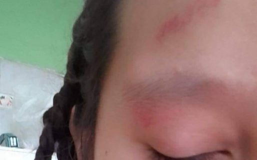 Golpearon a una nena a la salida de la Escuela N°184 dándole rodillazos en la cara